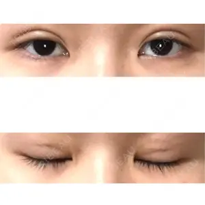 青森タウン形成外科クリニック口コミ