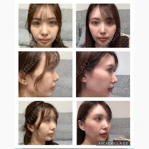 高崎美容クリニック口コミ