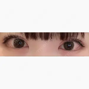 CLASSY 仙台美容外科・美容皮膚科口コミ