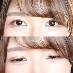 ツツイ美容外科口コミ