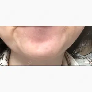 湘南美容クリニック 大阪あべの院口コミ