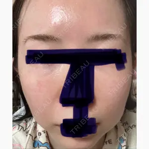 湘南美容クリニック 大阪あべの院口コミ