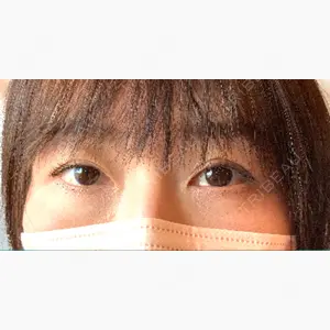 こまちクリニック口コミ