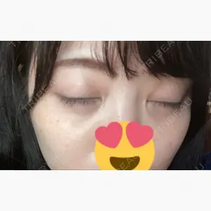 東京イセアクリニック口コミ