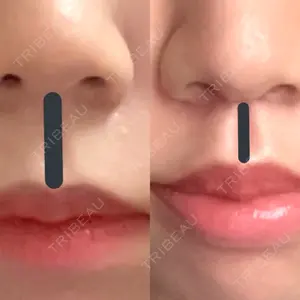 聖心美容クリニック 大阪院口コミ