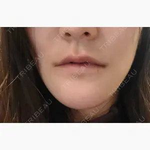 リラ・クラニオフェイシャル・クリニック 大阪院口コミ