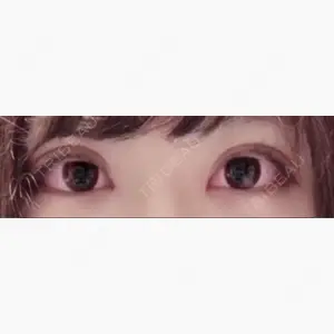 エートップ美容整形外科口コミ