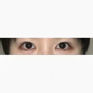 東京エビスクリニック口コミ