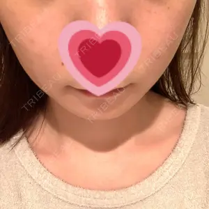 湘南美容クリニック 表参道院口コミ