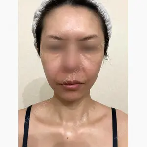 牧野美容クリニック口コミ