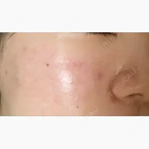 神戸ルミナスクリニック口コミ