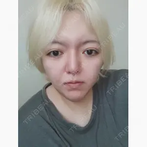品川美容外科 新宿院（※品川スキンクリニック提携）口コミ