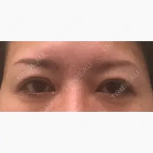 高田眼科併設眼瞼下垂治療センター口コミ