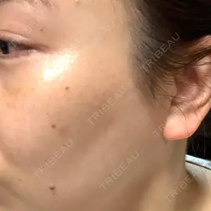 The Natural Beauty Clinic 四ツ橋院口コミ