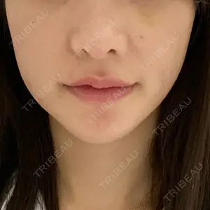 リッツ美容外科 東京院口コミ