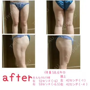 水の森美容クリニック 東京新宿院口コミ