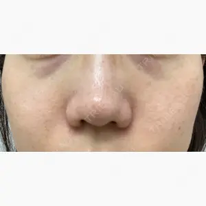 JMスマイルクリニック口コミ