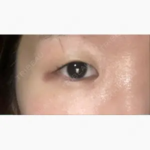 共立美容外科 新宿本院口コミ