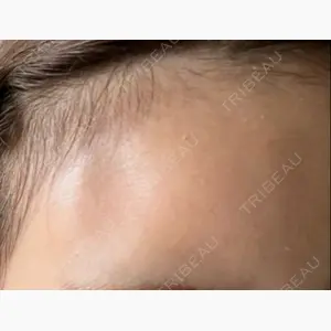 ニュービューティークリニック口コミ