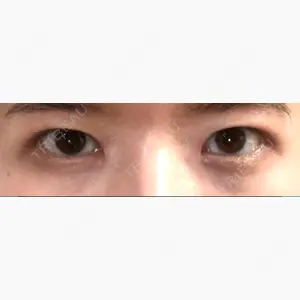 いちのせ形成外科・皮膚科 眼瞼＆フェイスクリニック口コミ