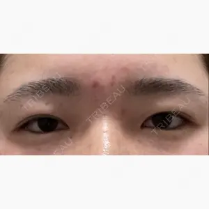 聖心美容クリニック 札幌院口コミ