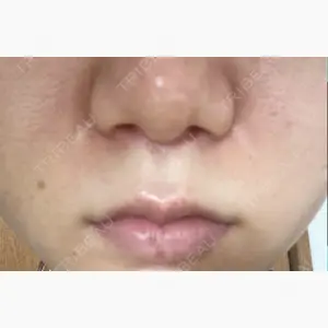 高崎美容クリニック口コミ