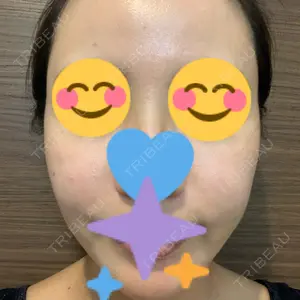 表参道レジュバメディカルクリニック口コミ