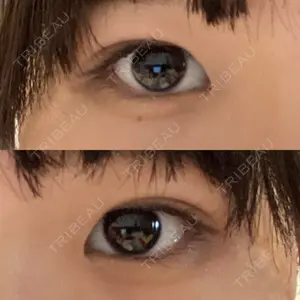 高崎美容クリニック口コミ