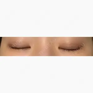 東京イセアクリニック口コミ