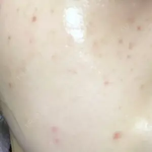 表参道メディカルクリニック 心斎橋院口コミ