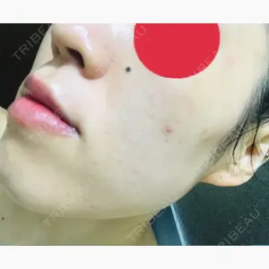 ハニークリニック口コミ