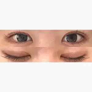 品川美容外科 梅田院口コミ