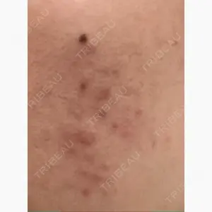 つばめ美容クリニック口コミ