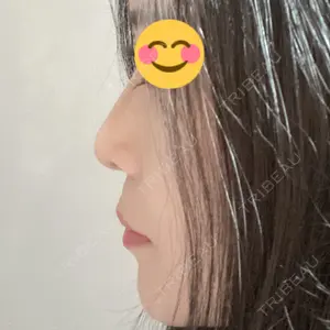 高崎美容クリニック口コミ