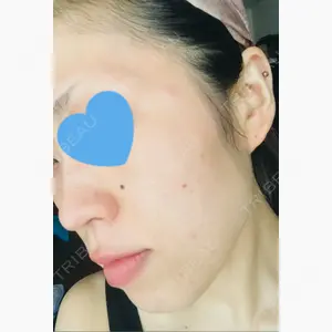 ハニークリニック口コミ