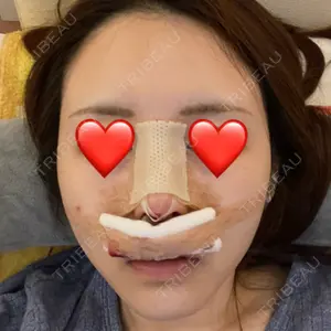 エートップ美容整形外科口コミ