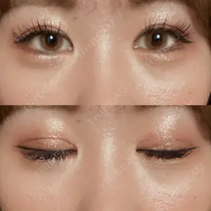蘇春堂形成外科口コミ