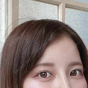 ニュービューティークリニック口コミ