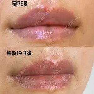 エールクリニック 大阪心斎橋口コミ