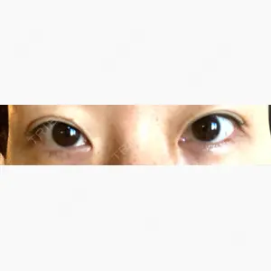 湘南美容クリニック 長野院口コミ