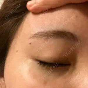 KOBE美容皮膚科 西宮院口コミ