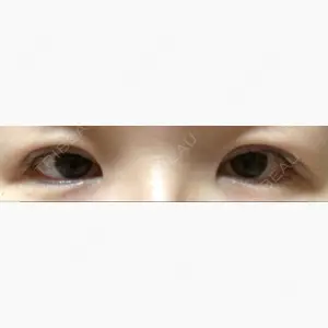 蘇春堂形成外科口コミ