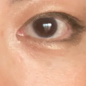 おきなわ美容クリニック口コミ