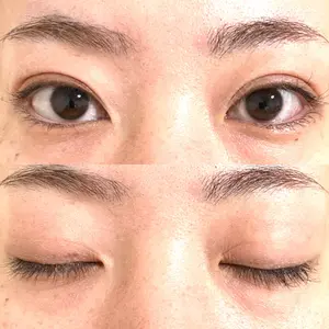 X CLINIC 恵比寿院口コミ