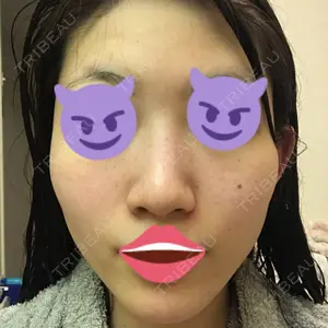 品川美容外科 名古屋院口コミ
