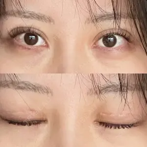 サラ美容外科口コミ
