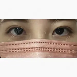 X CLINIC 恵比寿院口コミ