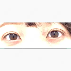 湘南美容クリニック 上野院口コミ