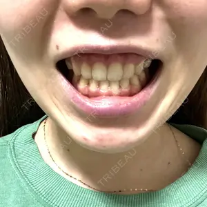 ルーセント歯科・矯正歯科口コミ