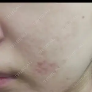 三鷹はなふさ皮膚科口コミ